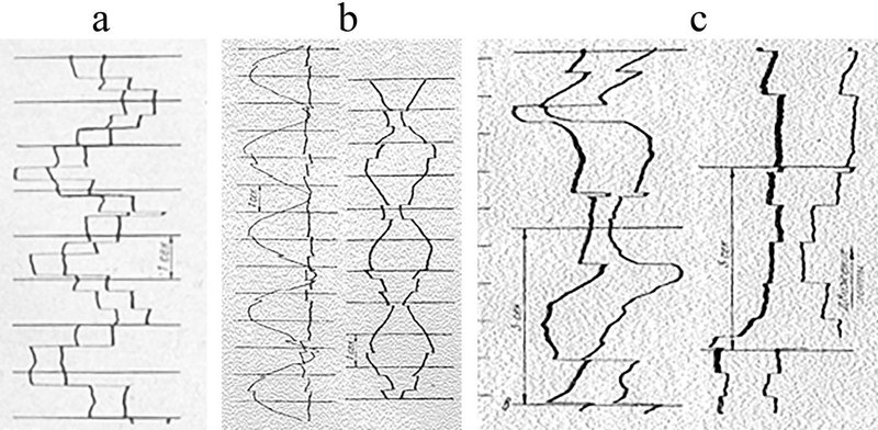 Records of the left and right eye movements: (a) in the course of viewing a plane picture; (b) during pursuit of a pendulum oscillating in the subject’s sagittal plane passing through the right eye (left pair of records) and between the eyes (right pair of records); &#40;c) while watching a fragment of stereo movie.